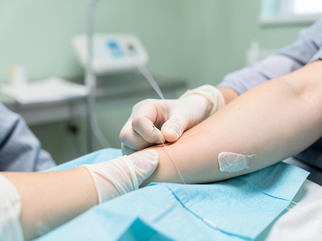 Surgical Scar Revision treatment